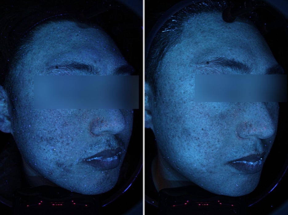피부과웨딩패키지? 잘못 받으면 돈만 날립니다 관련 이미지 3