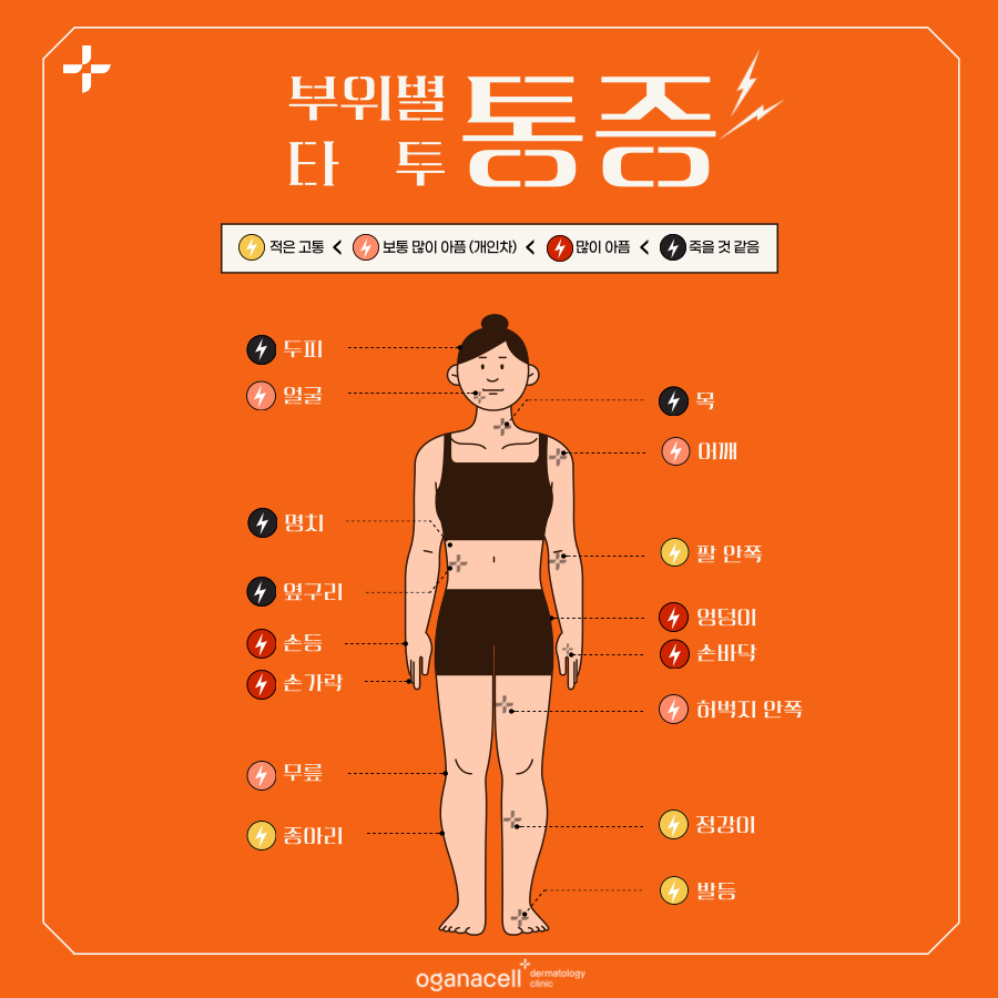 타투지우기 제거 깔끔하게 받으려면 관련 이미지 7