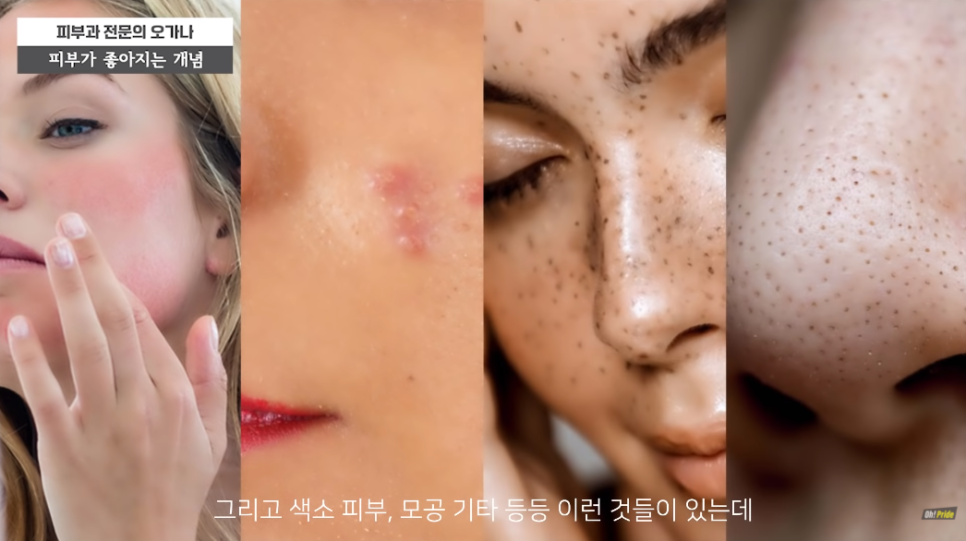 피부 좋아지는 법! 여드름, 민감성, 홍조, 모공 끝장내기 | 피부과전문의 오가나 관련 이미지 17