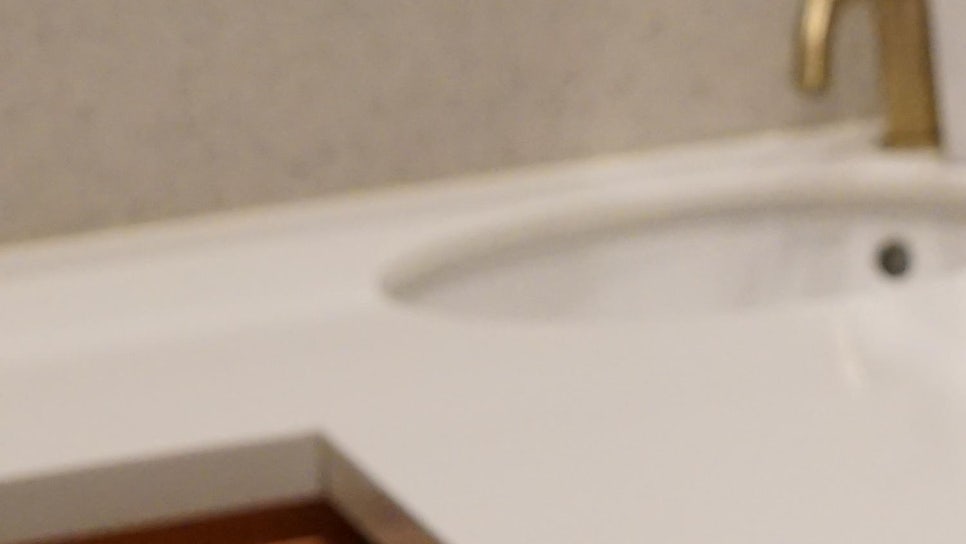 얼굴 색소침착 치료 가격만 보고 선택하면 후회합니다 관련 이미지 19