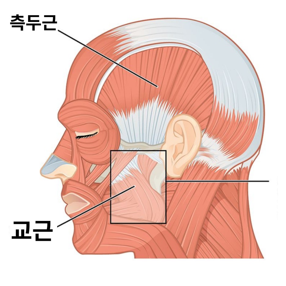 사각턱 보톡스 A to Z 원리, 부작용, 후기 관련 이미지 3