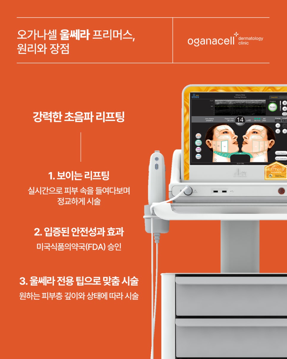 울쎄라프리머스와 다른 울쎄라의 차이점은? 관련 이미지 2