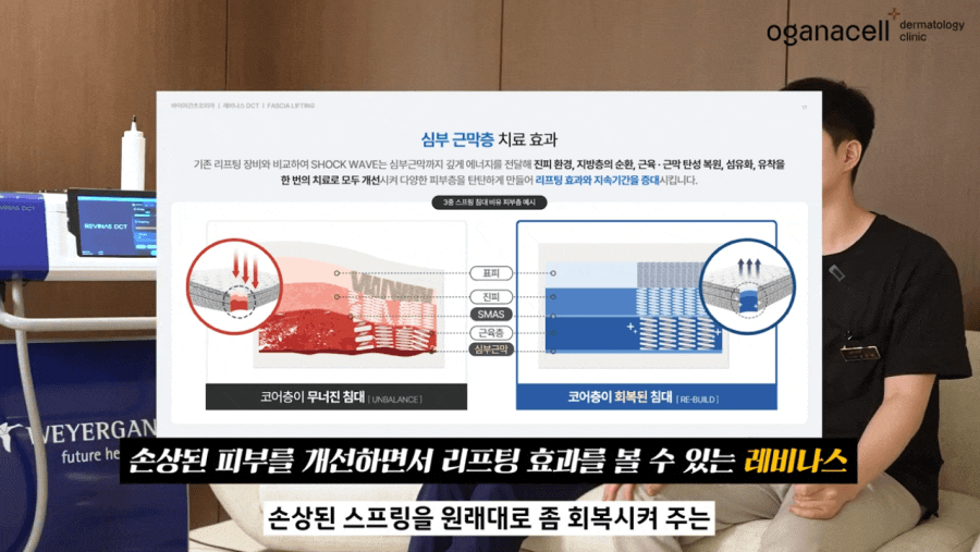 레비나스 리프팅 근막층 탄력을 탄탄하게 관련 이미지 4