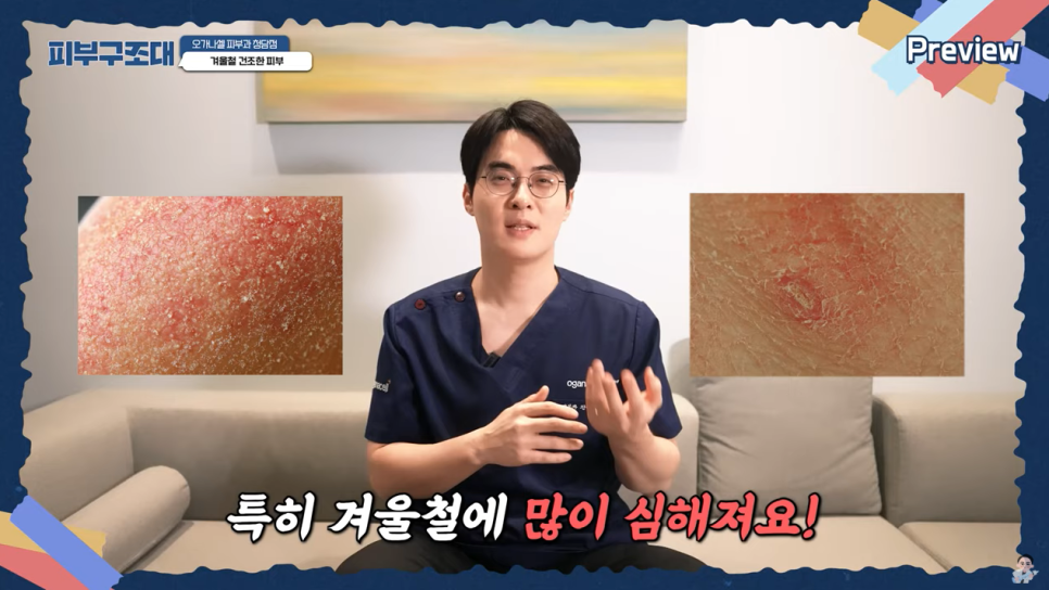 얼굴에 하얀 버짐, 겨울철 튼살 관리 이렇게 하세요! 관련 이미지 3