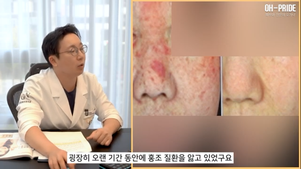 내 얼굴의 적신호 겨울철 안면 홍조! 관련 이미지 4