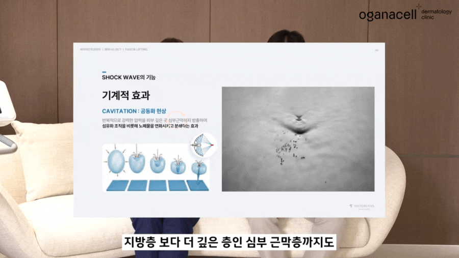 레비나스 리프팅 근막층 탄력을 탄탄하게 관련 이미지 9