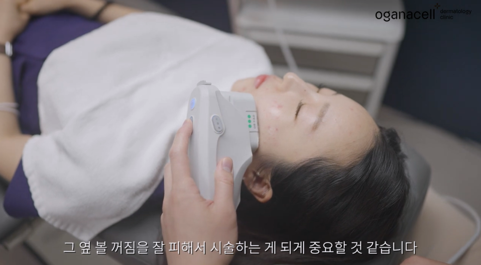 울쎄라 vs 써마지, 내 피부타입에 딱 맞는 리프팅 시술은? 관련 이미지 14