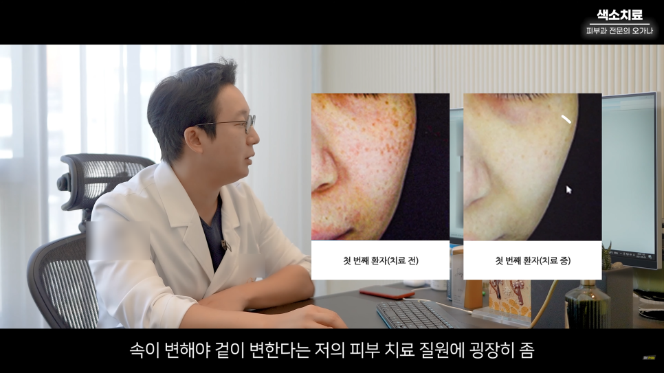 피부과 치료도 과유불급! 색소치료의 모든 것 #기미#색소병변#오타모반 | 오프라이드 오가나 관련 이미지 15