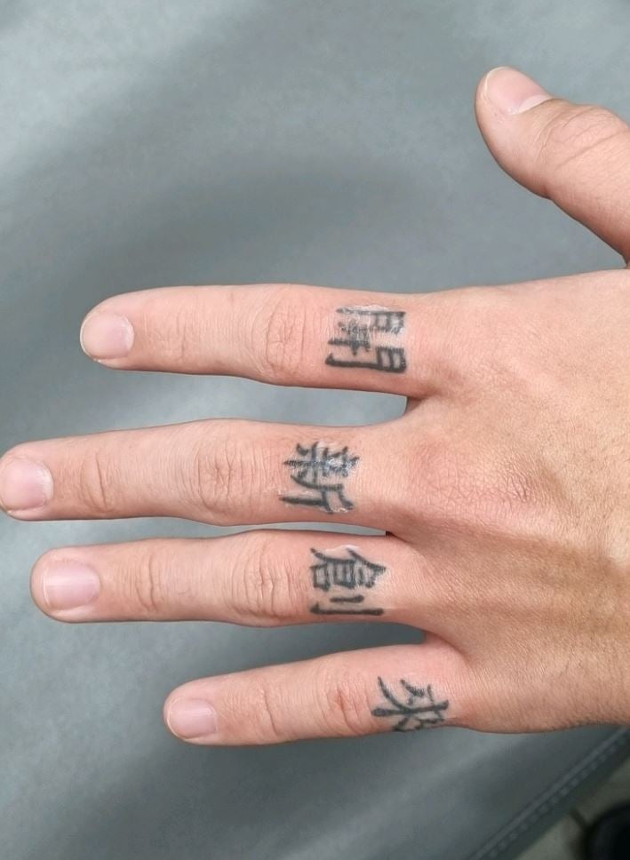 문신 제거 1회 만에 가능할까요? 전문의가 답변드립니다. 관련 이미지 2