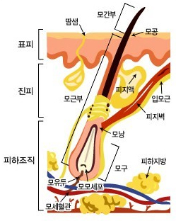 레이저 제모의 모든 것!(왁싱과 다른점) | 피부과전문의 오가나 관련 이미지 4