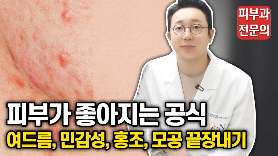 피부 좋아지는 법! 여드름, 민감성, 홍조, 모공 끝장내기 | 피부과전문의 오가나 관련 이미지 1