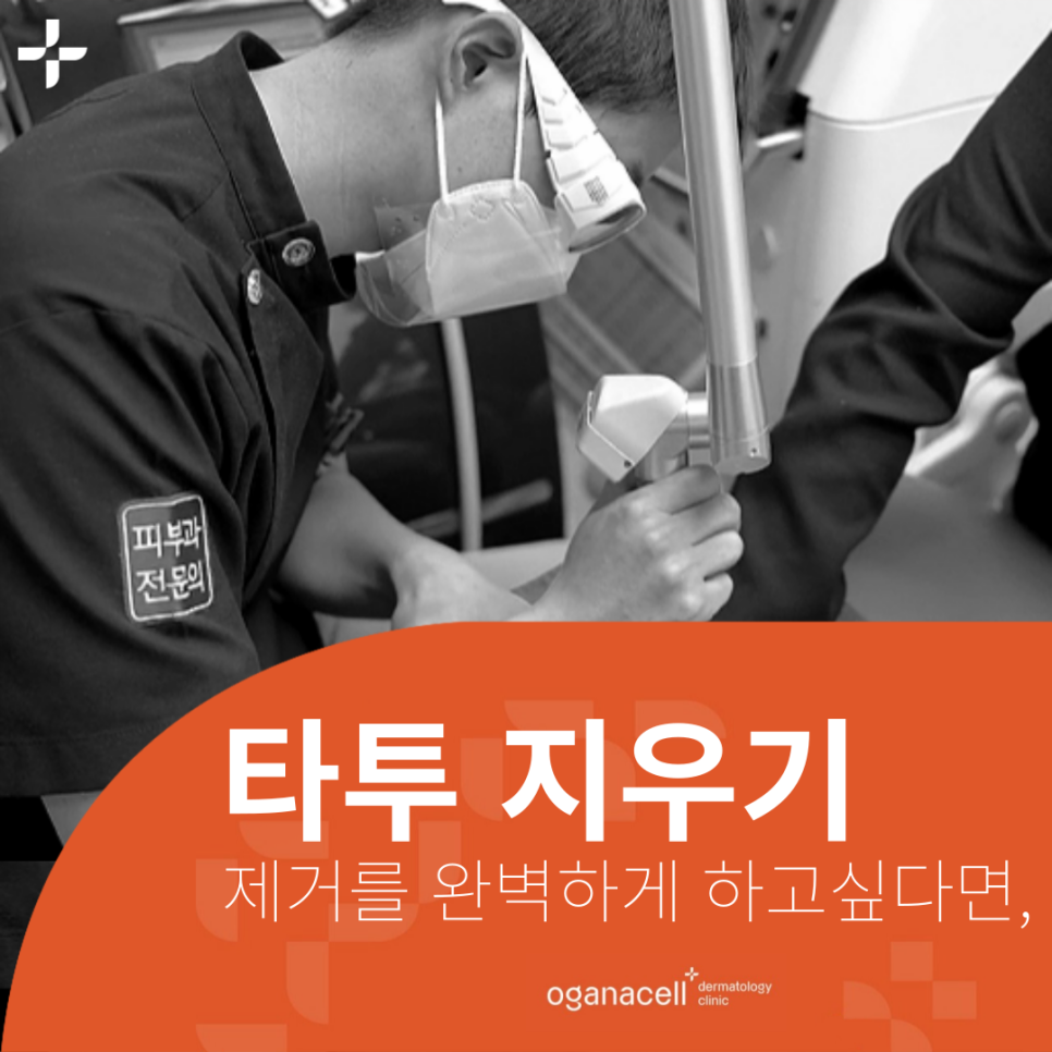 타투지우기 제거 깔끔하게 받으려면 관련 이미지 1