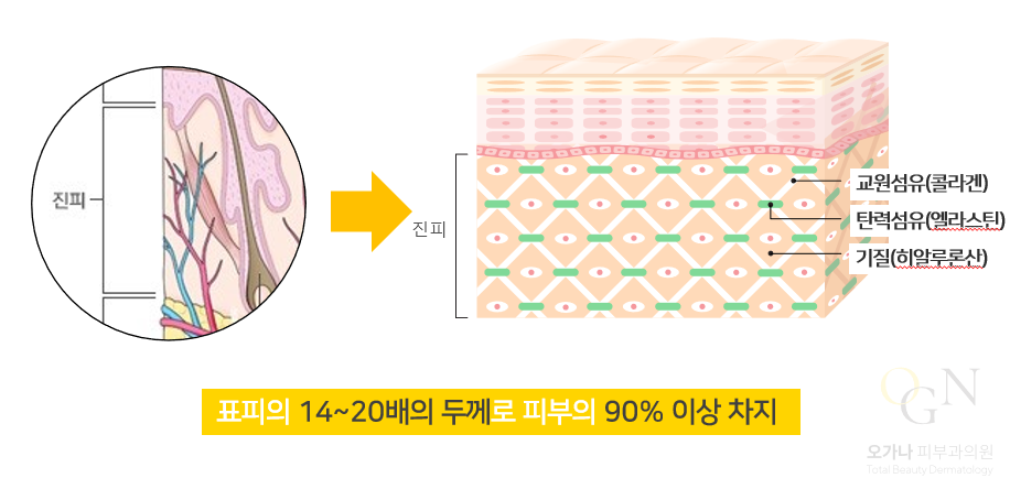 피부의 구조(표피, 진피, 피하조직) | 피부과전문의 오가나 관련 이미지 10