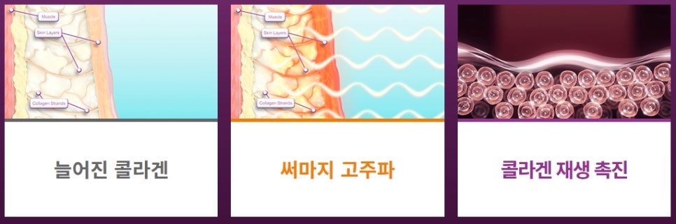 연예인은 청담동 피부과에서 어떤 시술을 받을까? | 피부과전문의 오가나 관련 이미지 7