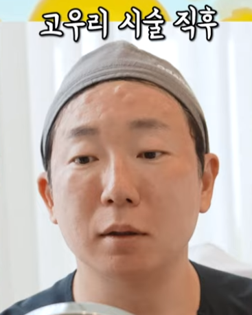 3세대 스킨부스터 등장(feat. 고우리 첫 사용 리뷰) 관련 이미지 10