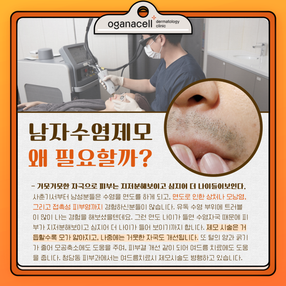 남자수염제모 가격 통증 궁금하다면 관련 이미지 3