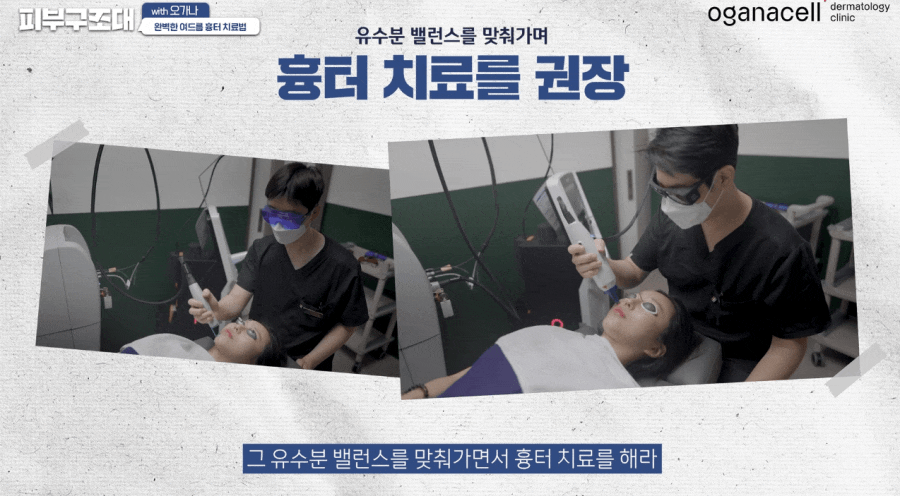 여드름 패인흉터 치료 방법 제대로알자 관련 이미지 6