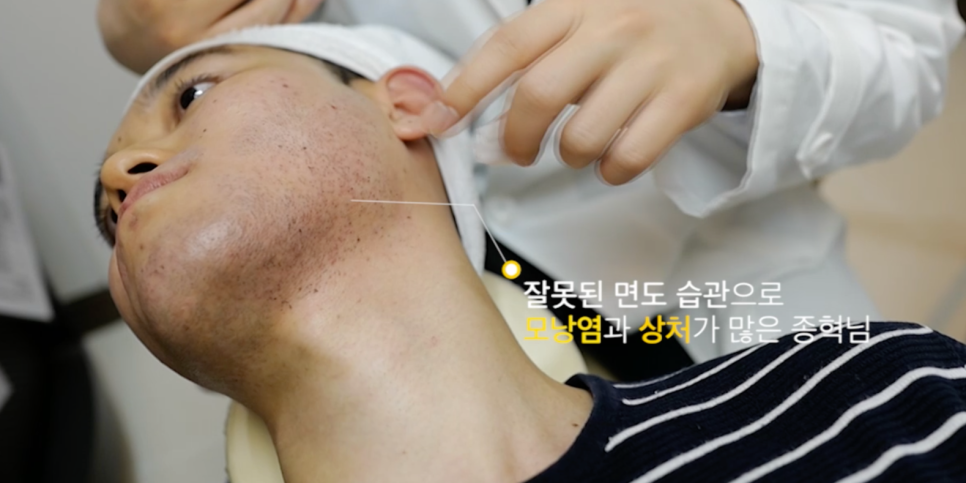 남자수염제모후기? 안 아프게 받는 방법 <대공개> 관련 이미지 3