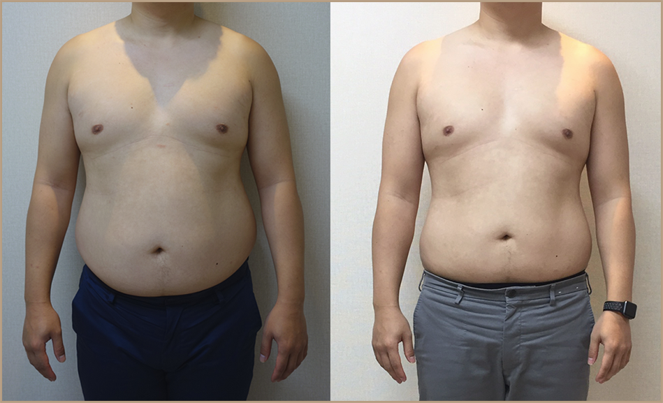 바디인모드 복부 주기는 어떻게 관련 이미지 8