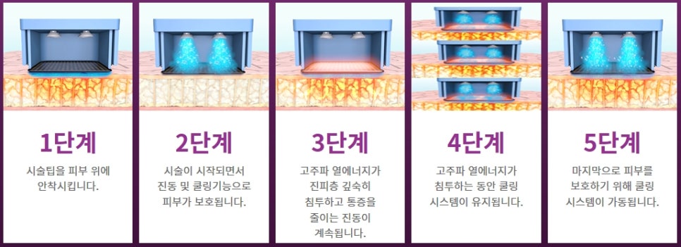 연예인은 청담동 피부과에서 어떤 시술을 받을까? | 피부과전문의 오가나 관련 이미지 8