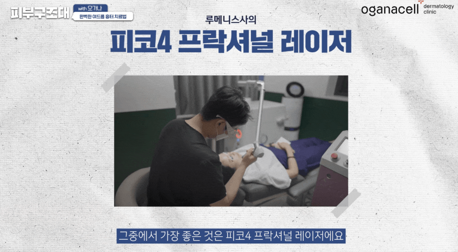 여드름 패인흉터 치료 방법 제대로알자 관련 이미지 17