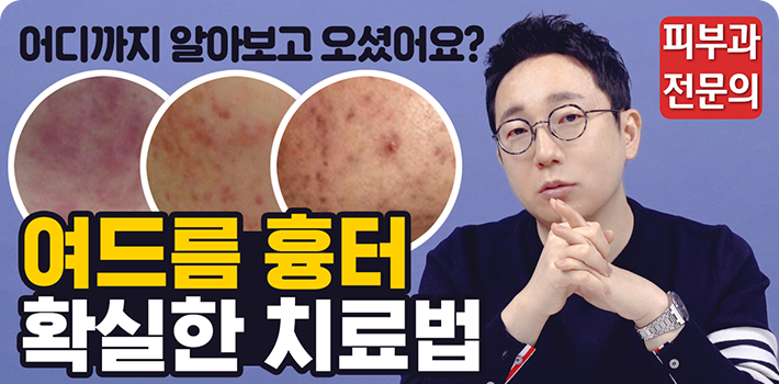 여드름 흉터 치료 가장 확실한 치료법 알려드립니다! | 피부과전문의 오가나 관련 이미지 1