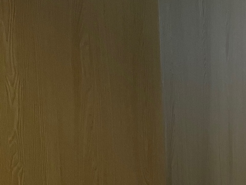 주름 보톡스 효과를 못 보신 분들의 공통점 관련 이미지 23