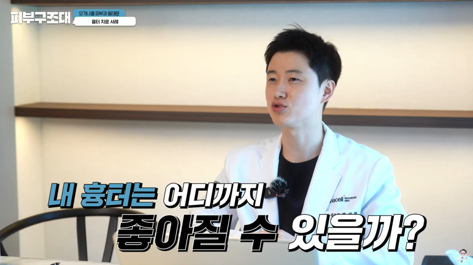 여드름 흉터 쥬베룩 어디까지 좋아질 수 있을까? 관련 이미지 2