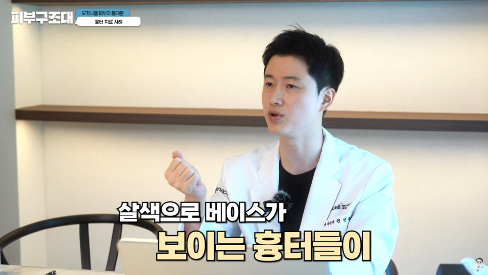 여드름 흉터 쥬베룩 어디까지 좋아질 수 있을까? 관련 이미지 7