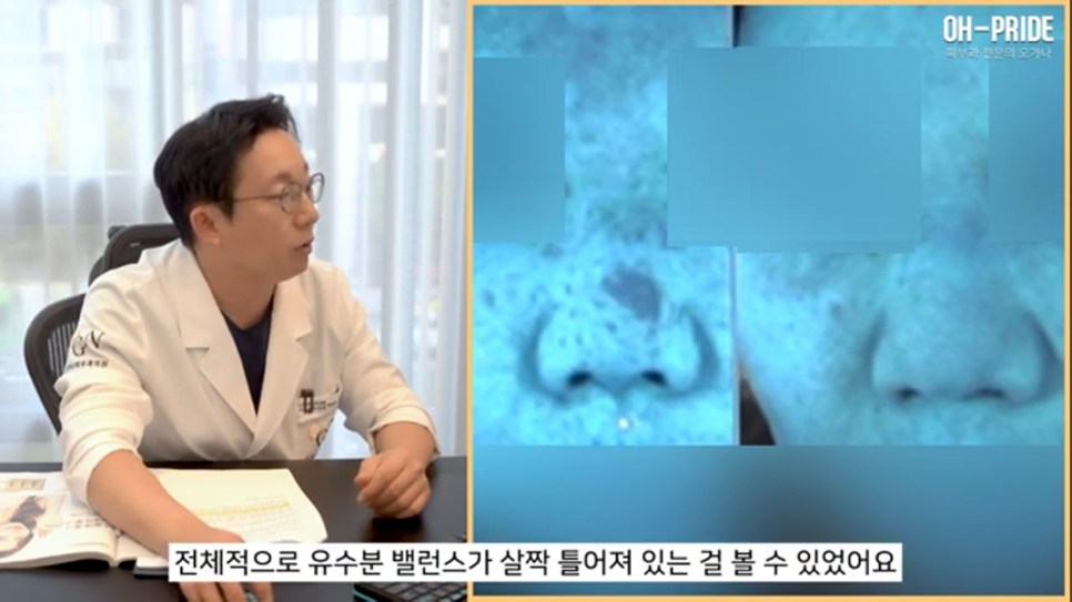 내 얼굴의 적신호 겨울철 안면 홍조! 관련 이미지 5