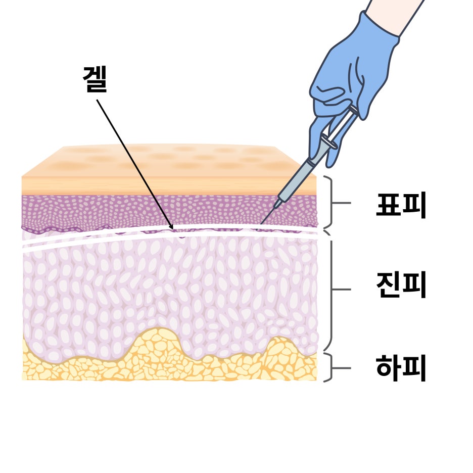 스킨부스터 고민 중이신 분들에게, 이걸 기준 삼아 보세요 관련 이미지 6