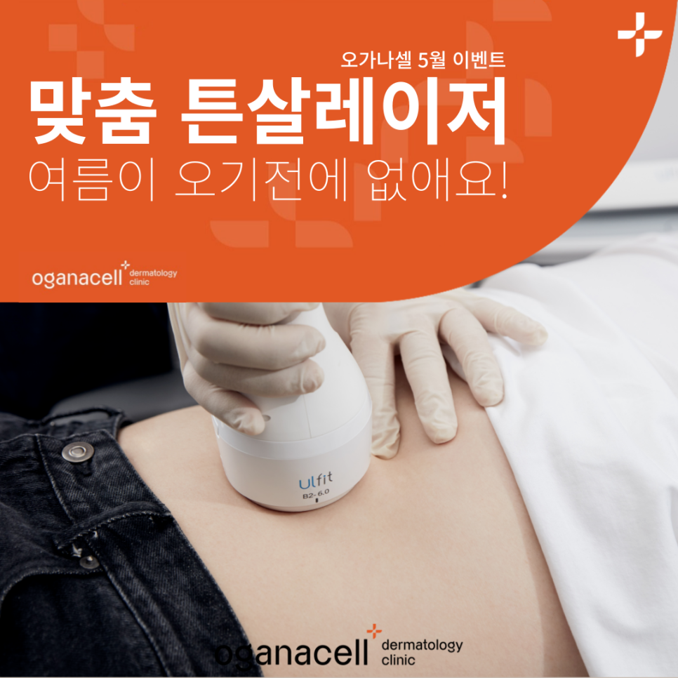 청담역 피부과 튼살레이저 여름대비 관련 이미지 1