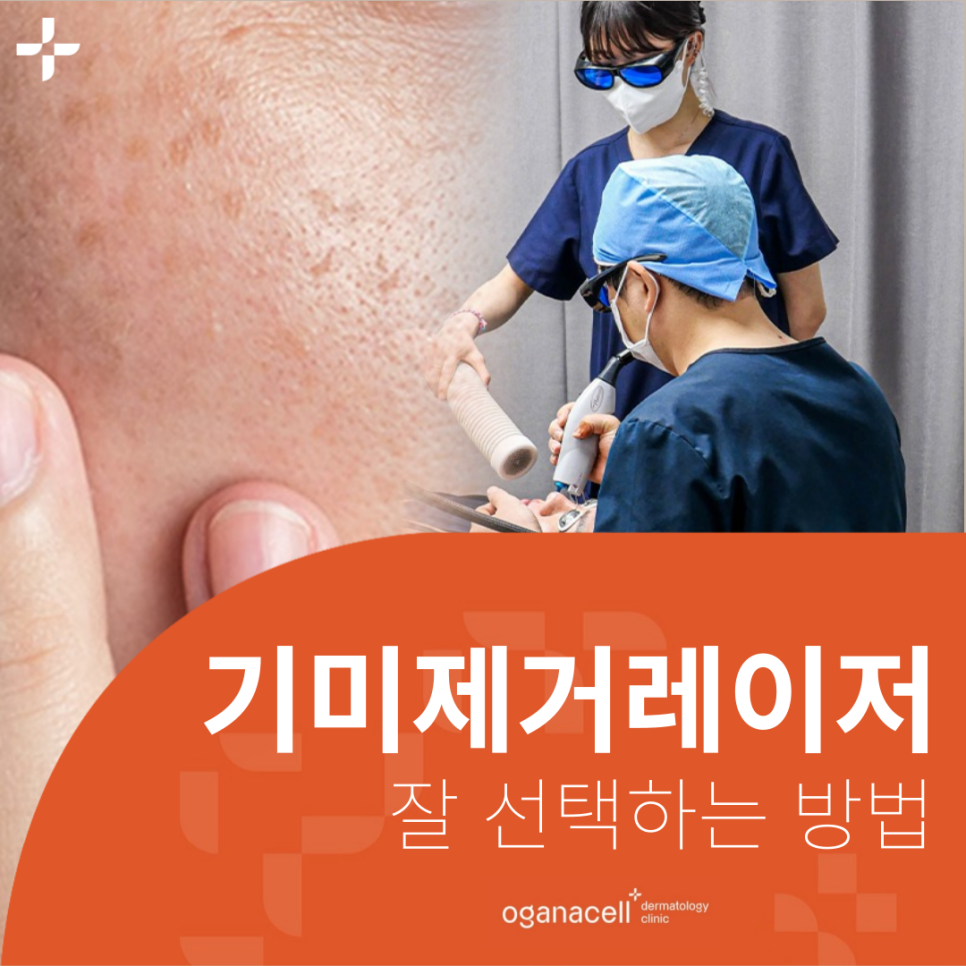 기미제거레이저 토닝 유명한곳 가격은 관련 이미지 1