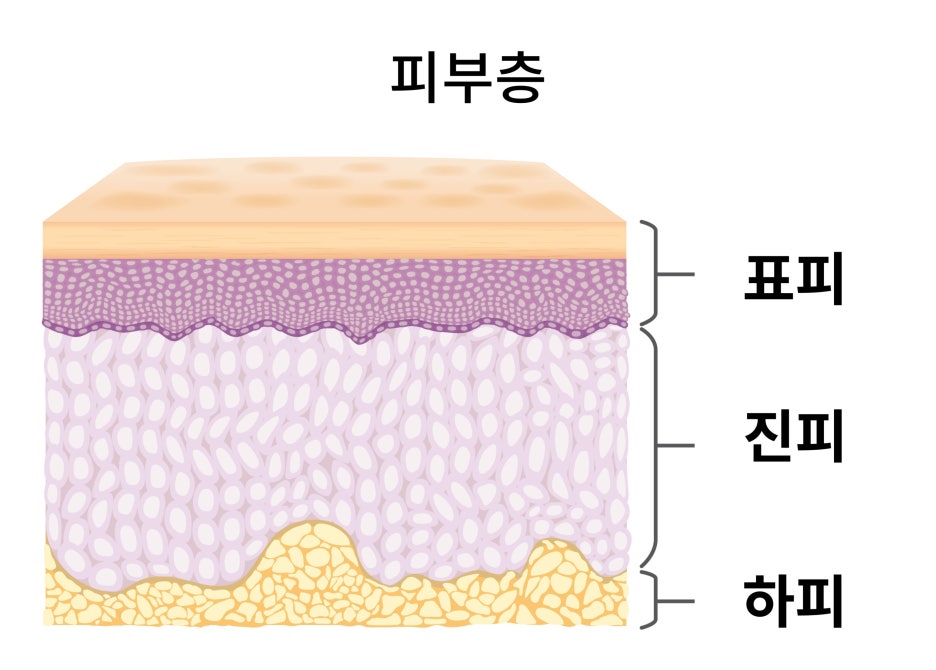 피부장벽 무너짐 원인과 크림 성분 3가지 추천 - 논문발췌 관련 이미지 2
