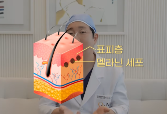 여드름 색소침착 레이저 치료, 꼭 확인해야 할 2가지 관련 이미지 5