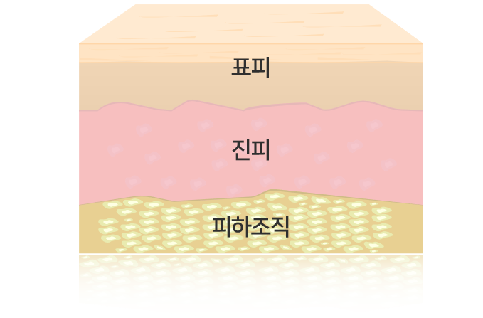 피부의 구조(표피, 진피, 피하조직) | 피부과전문의 오가나 관련 이미지 2