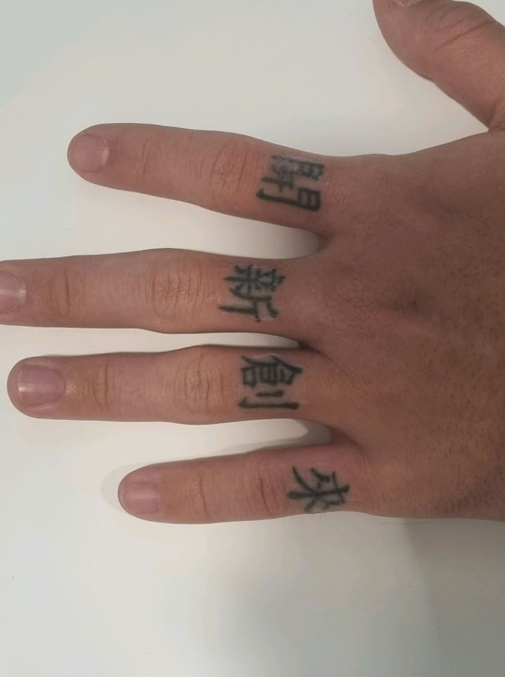 문신 제거 1회 만에 가능할까요? 전문의가 답변드립니다. 관련 이미지 5