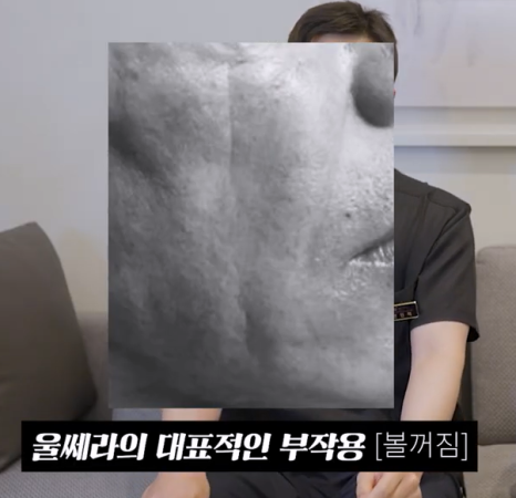 울쎄라 vs 써마지, 내 피부타입에 딱 맞는 리프팅 시술은? 관련 이미지 17