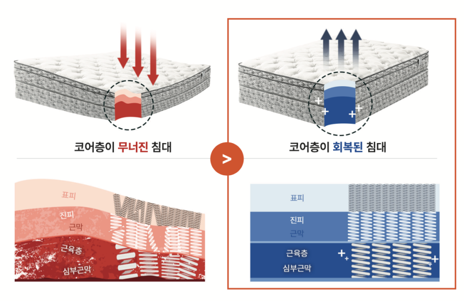 삼성역 인근 피부과 기미, 오타모반? 둘 다 아닐 수 있어요 관련 이미지 5