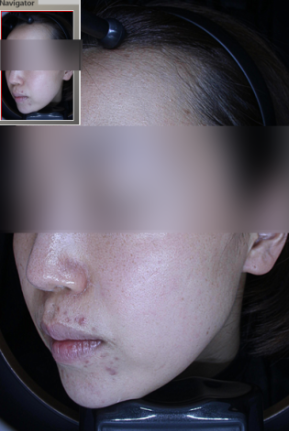 백옥주사 글루타치온? 연예인 피부 미백의 비밀과 진실 관련 이미지 13