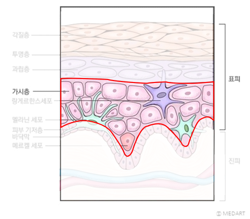 피부의 구조(표피, 진피, 피하조직) | 피부과전문의 오가나 관련 이미지 8