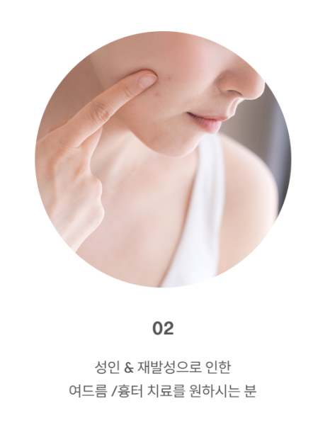 좁쌀 여드름 레이저 시술 전 필독! 이거 알고 받으세요! 관련 이미지 20