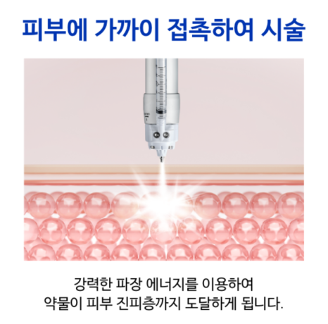 튼살 피부과에서 알려주는 붉은 튼살과 하얀 튼살 차이점 관련 이미지 10
