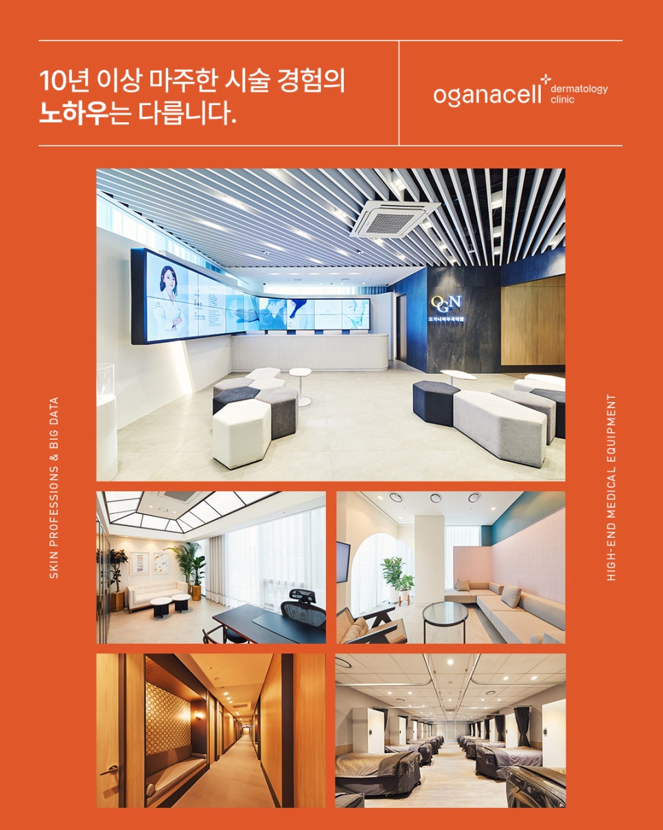 울쎄라프리머스와 다른 울쎄라의 차이점은? 관련 이미지 5