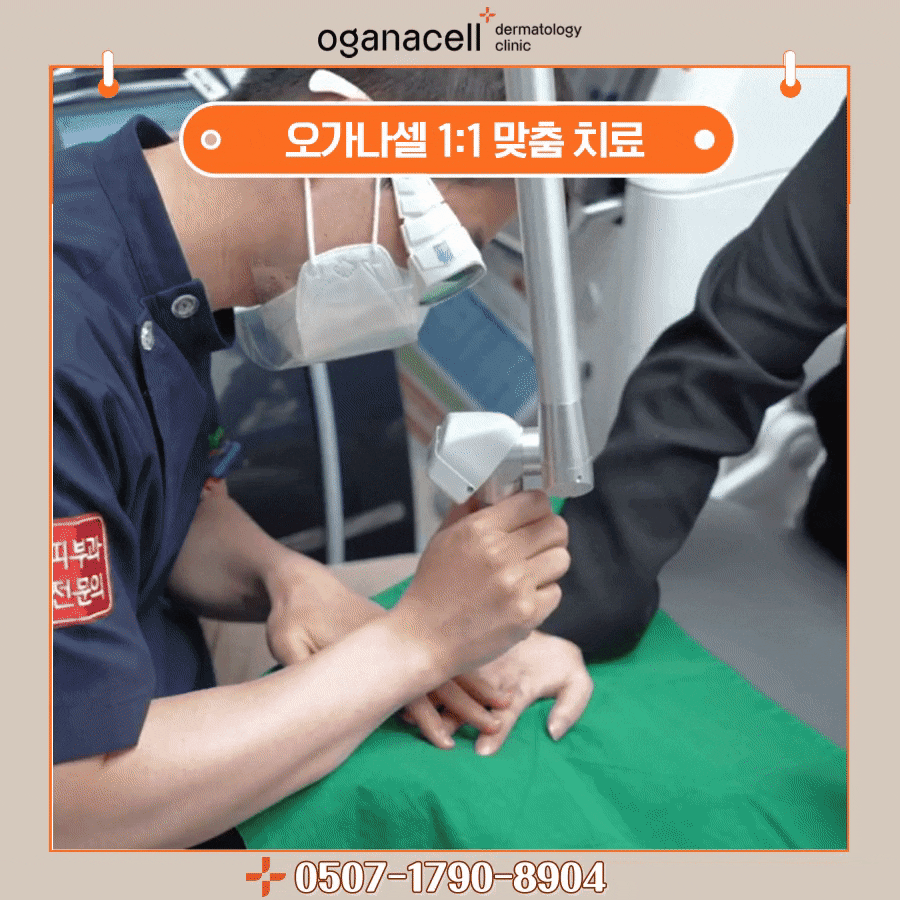 타투지우기 제거 깔끔하게 받으려면 관련 이미지 5