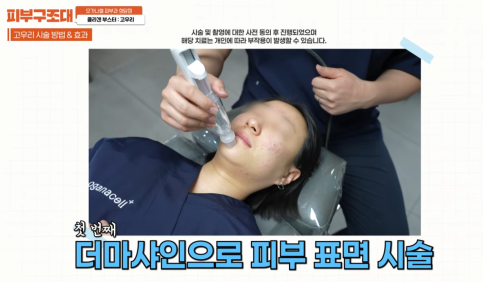 3세대 스킨부스터 등장(feat. 고우리 첫 사용 리뷰) 관련 이미지 5