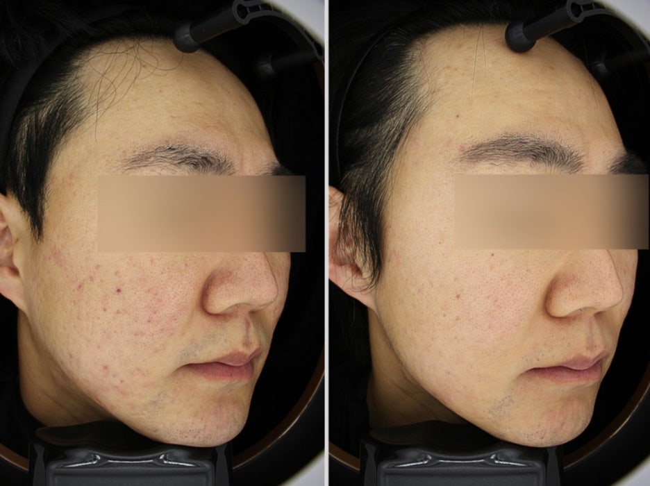 피부과웨딩패키지? 잘못 받으면 돈만 날립니다 관련 이미지 2
