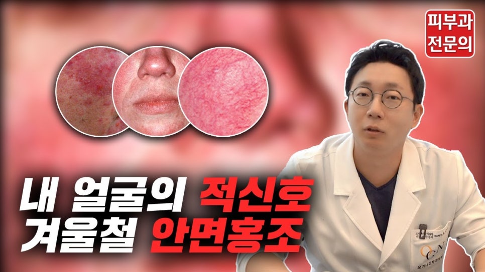 내 얼굴의 적신호 겨울철 안면 홍조! 관련 이미지 1