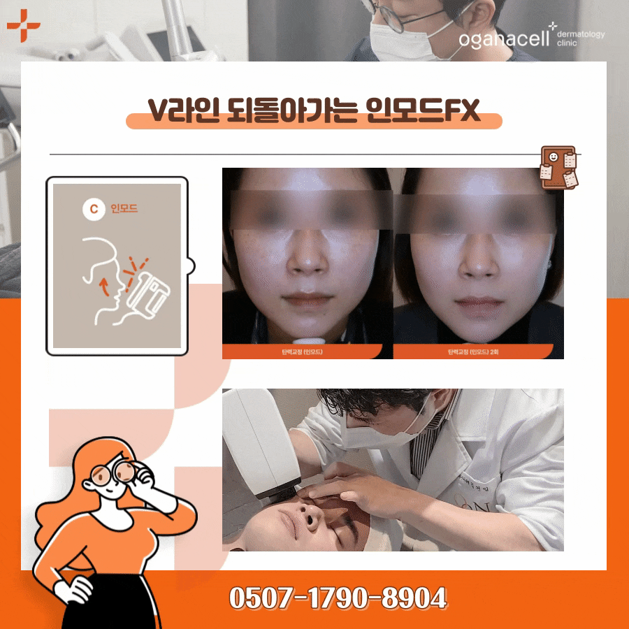 청담 인모드FX V라인완성 통증은? 관련 이미지 16
