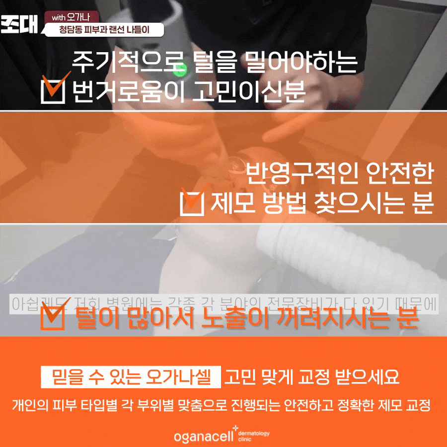 남자수염제모 가격 통증 궁금하다면 관련 이미지 12